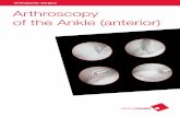 Orthopaedic Surgery - Anthroscopy of the Ankle