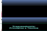 Traqueostomia - Final
