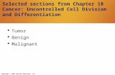 Copyright © 2009 Pearson Education, Inc. Selected sections from Chapter 18 Cancer: Uncontrolled Cell Division and Differentiation  Tumor  Benign  Malignant.