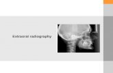 Extraoral radiography. MAIN MAXILLOFACIAL PROJECTION Standard occipitomental 0º 30º Occipitomental Posteroanterior of the skull Posteroanterior of the.