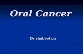 Oral Cancer Dr shabeel pn. What Is Cancer? Diseases containing abnormal cells that divide and spread uncontrollably Diseases containing abnormal cells.