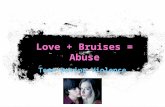 Love + Bruises = Abuse Teen Dating Violence. Lets Talk About…. Defining Abuse What they mean & who the victims are? Who abuses more? Red Flags Why do.