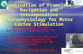 Combination of Frameless Navigation and Intraoperative Neurophysiology for Motor Cortex Stimulation Konstantin Slavin, MD, and Keith R. Thulborn, MD, PhD.