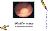 Bladder tumor dr,mohamed fawzi alshahwani 1. facts Bladder cancer is the second most common cancer of the genitourinary tract.Bladder cancer is the second.