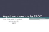 Agudizaciones de la EPOC Dra. Lourdes González Neumología 2015.