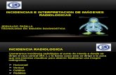 Incidencias e Interpretacion de Imágenes Radiologicas