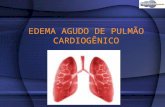 EDEMA AGUDO DE PULMÃO CARDIOGÊNICO. CONCEITO Edema agudo de pulmão consiste na Insuficiência respiratória súbita e progressiva devido ao extravasamento.