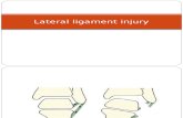 Lateral Ligament Injury