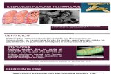 Tuberculosis Pulmonar y Extrapulmonar MI Hernandez