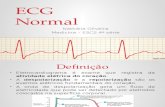 Apresentação ECG normal