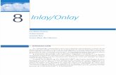 Inlay - Onlay Espanhol
