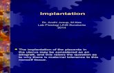 4. Implantation