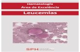 Hematologia - Leucemias