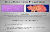 Gastro - Insuficiencia Hepatica