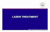 Laser Treatment for Glaucoma