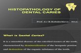 PD 4.Histopathology of Dental Caries