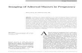 imaging of adenxal masses in pregnancy.pdf