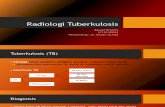 Radiologi Tuberkulosis