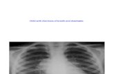 Bronchopulmonary Malformations