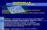 K22 Varicella