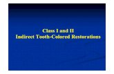 Class I and II Indirect Tooth-Colored Restorations (4,5)