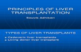 Principles of Liver Transplantation