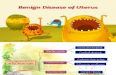 Benign Disease of Uterus