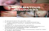 Eczematous Disorders CFM REPORT 2.ppt
