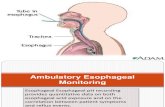 Ambulatory Esophageal