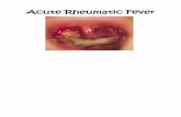K - 6 Acute Rheumatic Fever