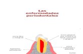 Periodontitis pacientes
