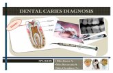 Dental Caries Diagnosis