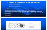 Ulcerul Gastric Si Duodenal1