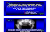 Treatment of late neglected adult congenital dislocation of the hip with hybrid Ilizarov/monolateral distractor and total hip replacement A new methodology