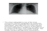 Easy to Miss on Chest Radiographs