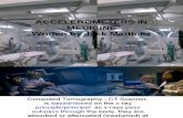 Accelerometers in Medicine Test 1