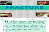 Fracture Its Final