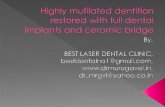 Highly mutilated dentition restore with full dental implants