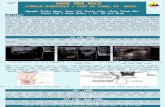 Poster FEMALE HYDROCELE [CYST of CANAL of NUCK], Dr PHAM THI THANH XUAN