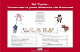 Clubfoot: Ponseti Management [Portuguese]