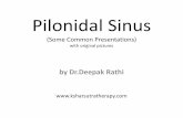 Pilonidal Sinus : Common Presentations with original pictures