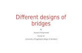 different designs of dental bridges