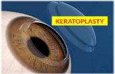 Keratoplasty patient education