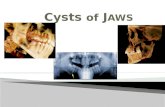 CYSTS OF THE JAW Part 1