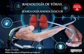 Semiología radiológica del tórax - 3a parte