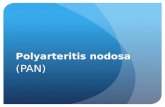 Polyarteritis nodosa
