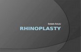 Rhinoplasty raju ppt full