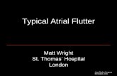 Typical Atrial Flutter..pdf