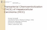 Transarterial Chemoembolization (TACE) of Hepatocellular ...