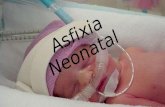 Asfixia neonatal grupo 5